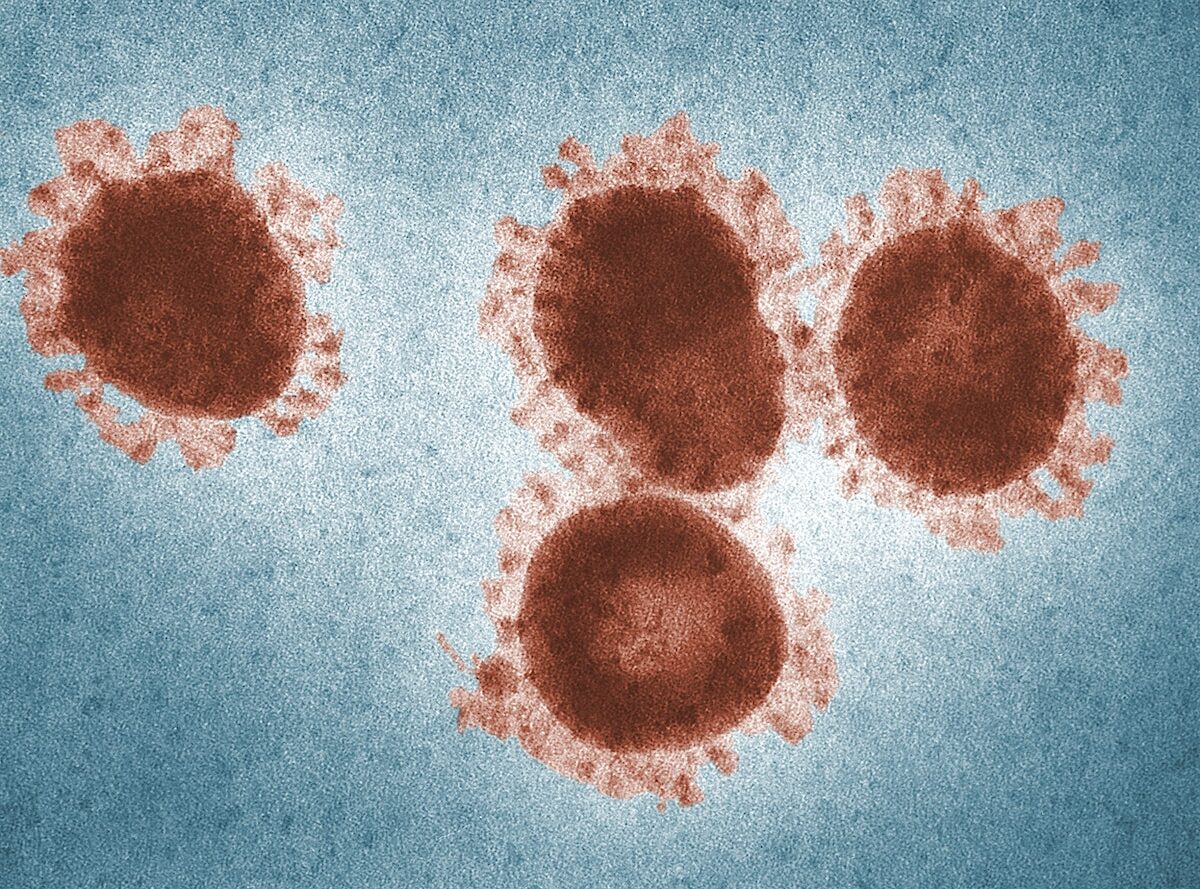 Microscopic Shot Of a Virus